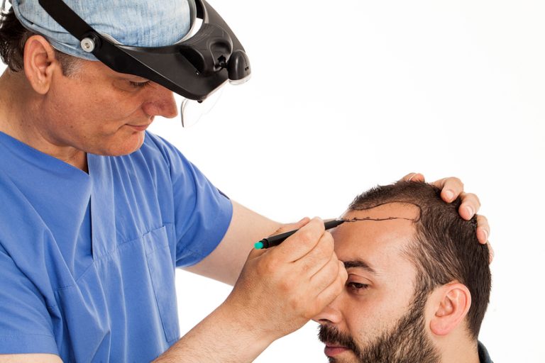How for the greatest Hair Surgery Doctors