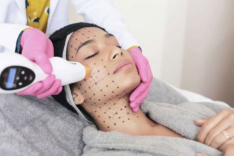 Keep Your Skin Looking Young and Beautiful with Thermage Treatments