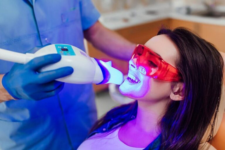 7 Tips to Take Care of Your Teeth After a Professional Teeth Whitening Session in Dallas